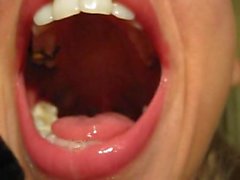 nice zoom on spitty mouth, gold crown mmmm